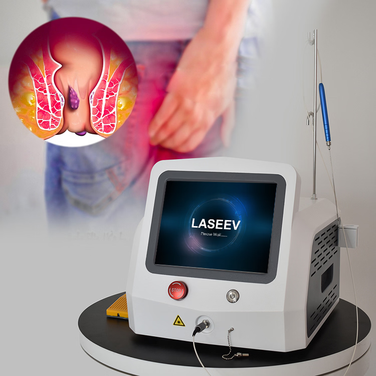 Painless Laser Proctology